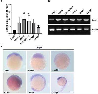 Pcgf1 Regulates Early Neural Tube Development Through Histone Methylation in Zebrafish